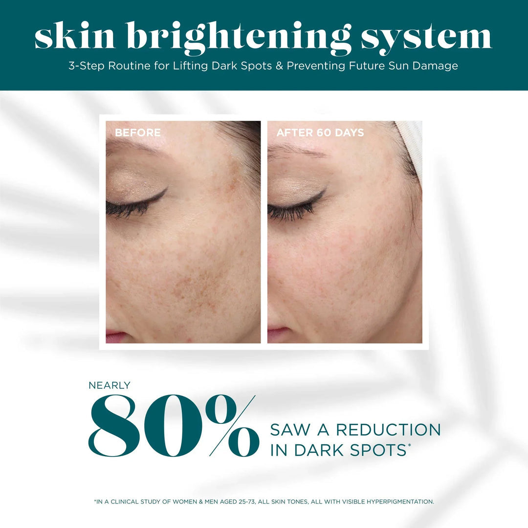 VI Derm Skin Brightening System