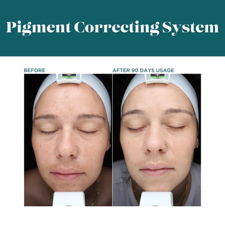 VI Derm Pigment Correcting System